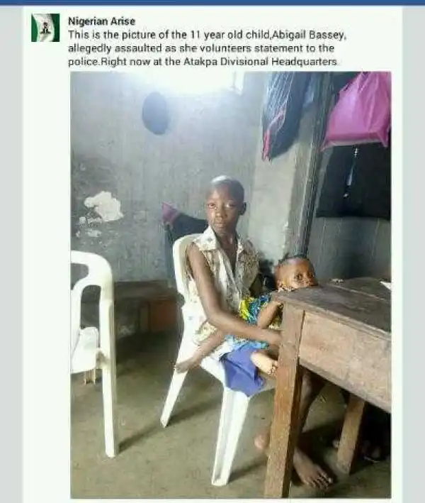 Woman Stabs Her Hungry Maid With Knife In Calabar, Throws Her Out Unclad (Photos)